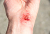 Hypochlorous Acid: An Ideal Wound Care Agent With Powerful Microbicidal, Antibiofilm, and Wound Healing Potency