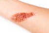 Hypochlorous Acid as a Potential Wound Care Agent
